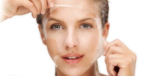 Peeling Químico