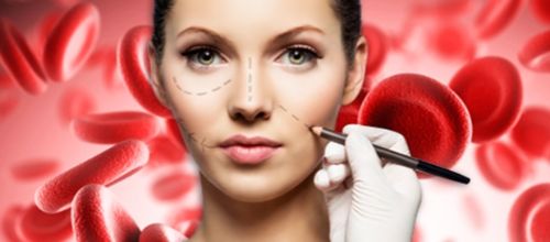 Plasma Rico en Plaquetas (PRP)