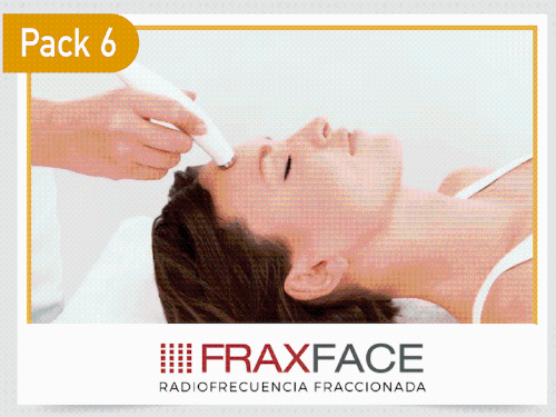 Image FraxFace - Rejuvenece Ahora. Rejuvenece Sin Dolor.